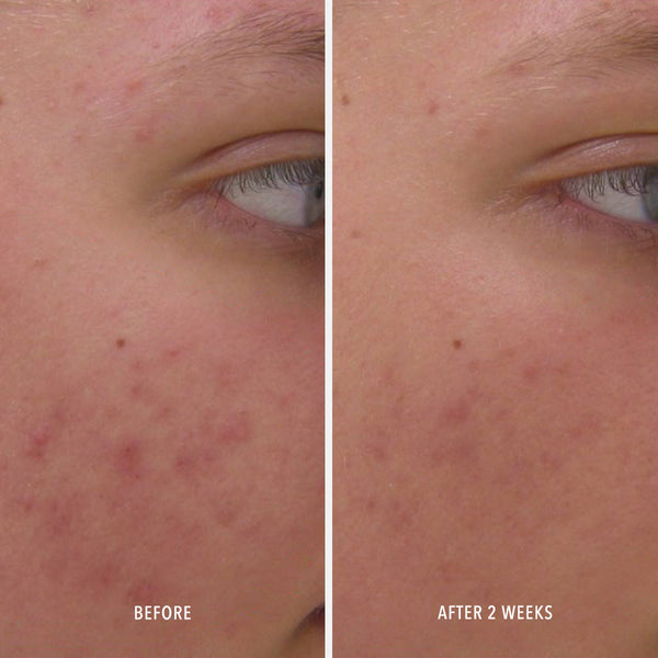 HydroPeptide Clear Rescue - product image 3