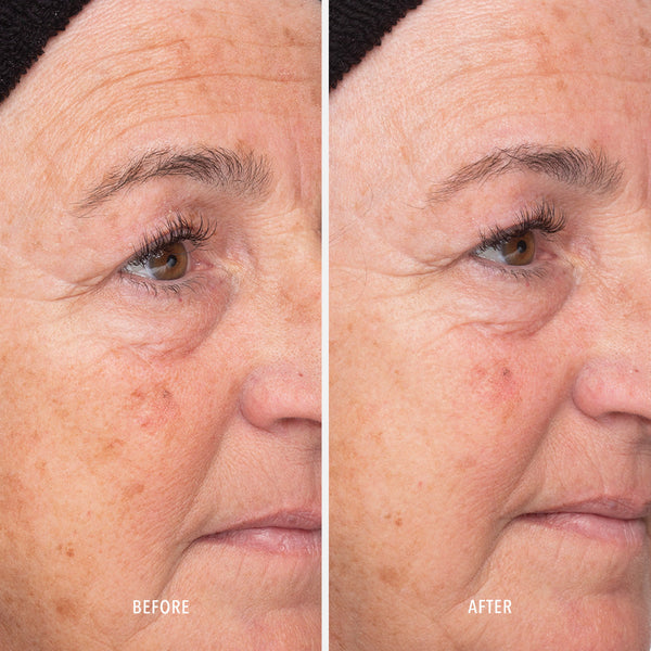 HydroPeptide Liquid Resurfacing Solution - product image 4