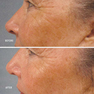 HydroPeptide LumaPro-C Serum - product image 6