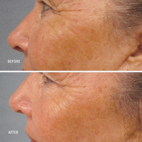 HydroPeptide LumaPro-C Serum - product image 6