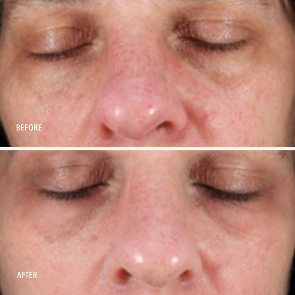 HydroPeptide Travel-Size Collagen ReActivate PM - product image 4