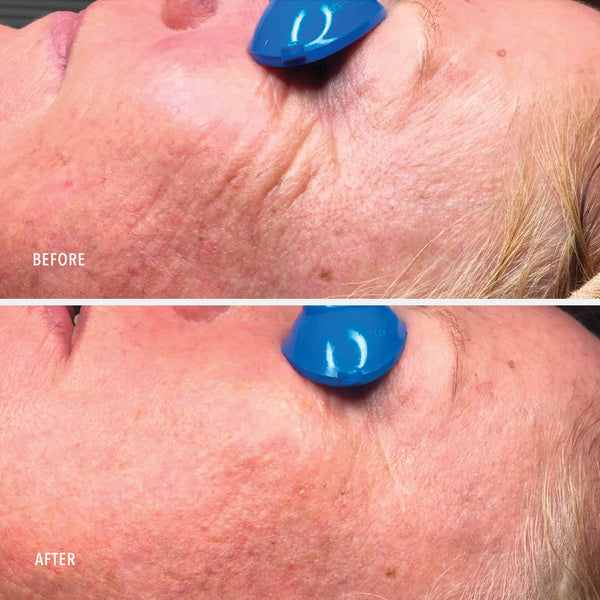 HydroPeptide Travel-Size Collagen ReActivate PM - product image 5