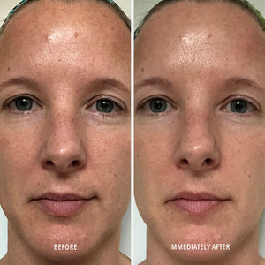 HydroPeptide Polish & Plump Face Peel - product image 4