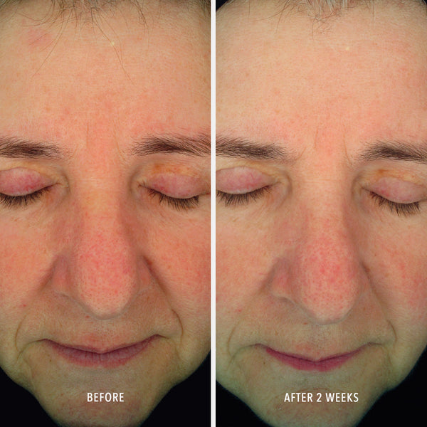 HydroPeptide Soothing Serum - product image 4