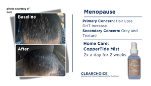 ClearChoice Coppertide Mist- O Ceuticals Collection 120ml - product image 3