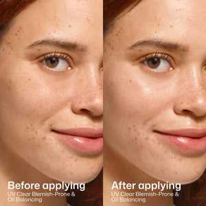 EltaMD UV Clear Blemish-Prone & Oil Balancing SPF 50 product image 6