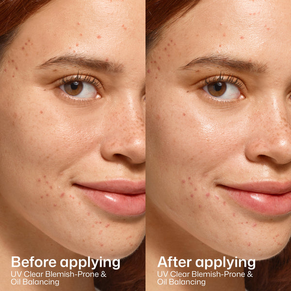 EltaMD UV Clear Blemish-Prone & Oil Balancing SPF 50 product image 6