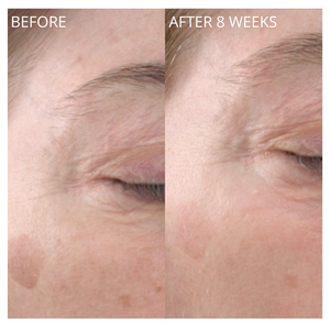 Glowbiotics Advanced Vitamin-C Brightening Serum - product image 12
