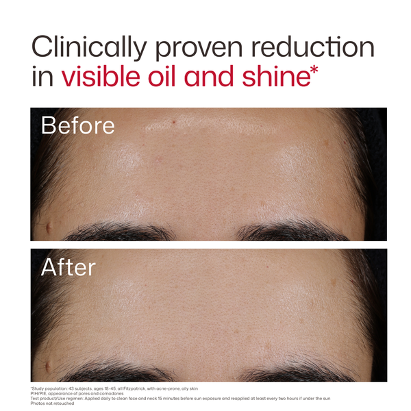 EltaMD UV Clear Blemish-Prone & Oil Balancing SPF 50 product image 8