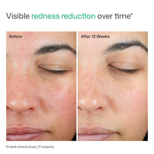 EltaMD UV Skin Recovery Broad Spectrum SPF 50 Face Sunscreen product image 8
