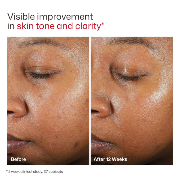EltaMD UV Clear Deep Tinted Broad Spectrum SPF 46 product image 10