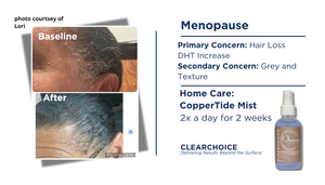 ClearChoice Coppertide Mist- O Ceuticals Collection 120ml - product image 2