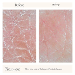 Le Mieux Collagen Peptide Serum bottle with before and after skin transformation images, showcasing skincare benefits