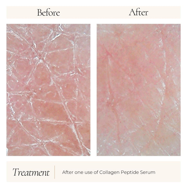Le Mieux Collagen Peptide Serum bottle with before and after skin transformation images, showcasing skincare benefits