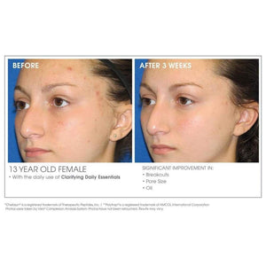 Glowbiotics Clarifying + Refining Serum - product image 4