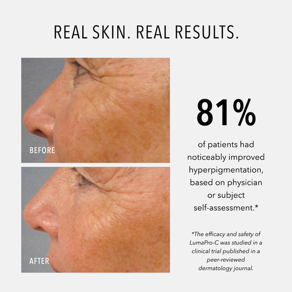 HydroPeptide Travel-Size LumaPro-C Face Serum - product image 5