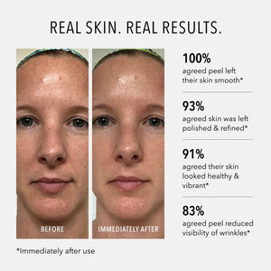 HydroPeptide Polish & Plump Face Peel - product image 3