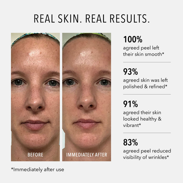 HydroPeptide Polish & Plump Face Peel - product image 3