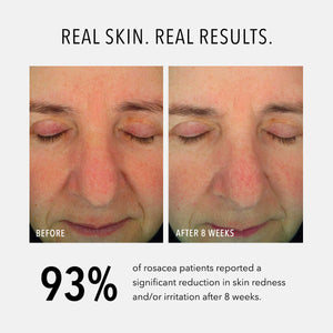 HydroPeptide Soothing Serum - product image 3