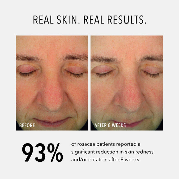 HydroPeptide Soothing Serum - product image 3