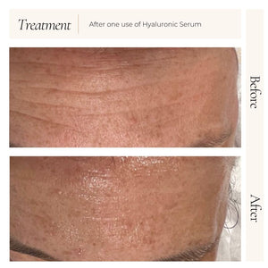 Le Mieux Hyaluronic Serum bottle with before and after skin hydration comparison, showcasing the serum's moisturizing effects.