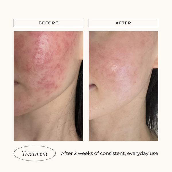 Le Mieux Iso-Cell Recovery Solution toner in a clear bottle with a white cap, designed for skincare recovery and hydration.