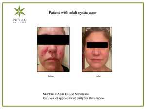 Phyto-C Skin Care Superheal™ O-Live Serum 30ml - European Beauty by B