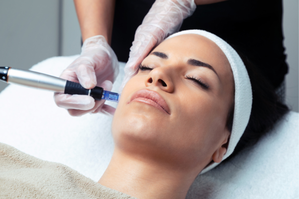 Customized facial voucher for PRP microneedling treatment at The Aesthetics Spa, showcasing skin rejuvenation benefits.