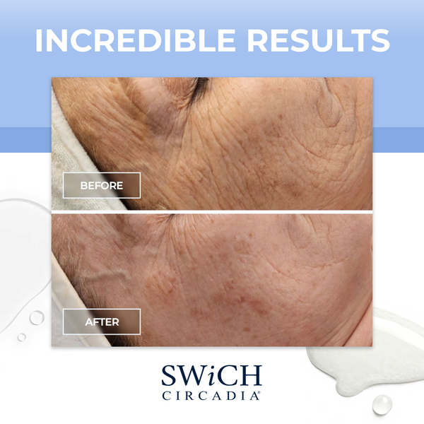 SWiCH Signature Facial - image 4