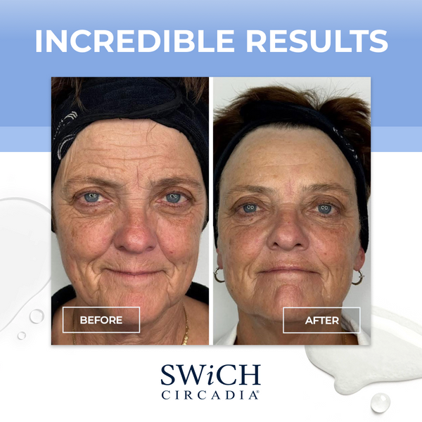SWiCH Signature Facial - image 6