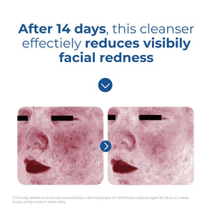 EltaMD Skin Recovery Amino Acid Foaming Cleanser product image 6