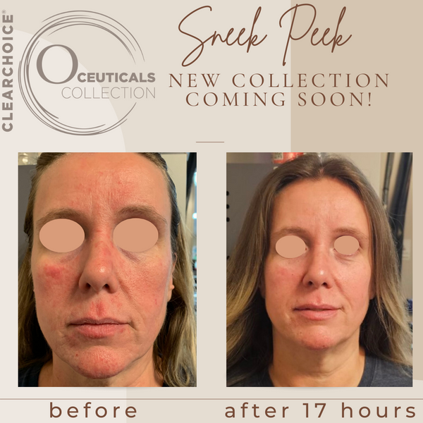 ClearChoice Coppertide Mist- O Ceuticals Collection 120ml - product image 4