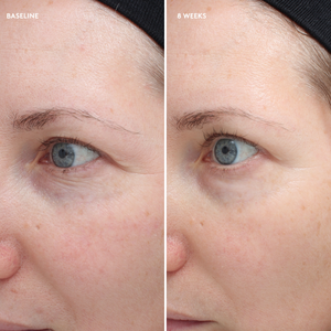 Colorescience Total Eye® Firm & Repair Cream - product image 7