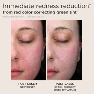 EltaMD Post-Procedure Skincare Kit product image 6