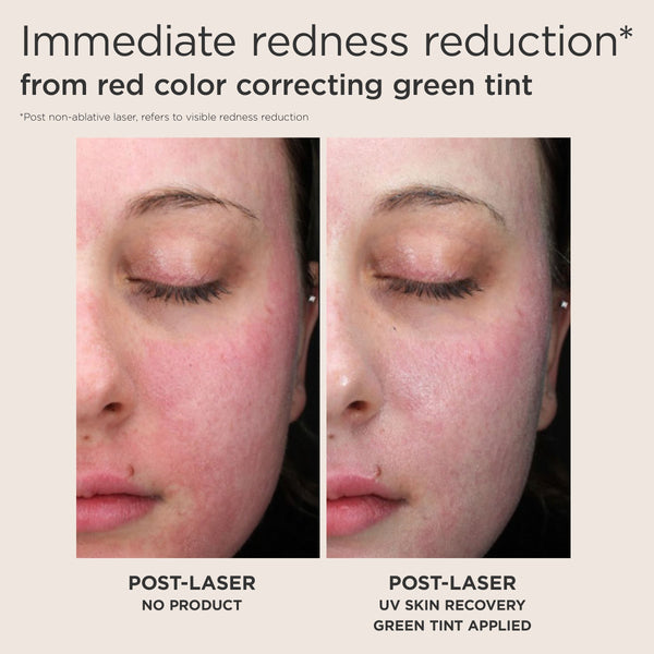 EltaMD Post-Procedure Skincare Kit product image 6