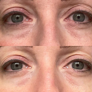 Bel Mondo Maxim Eyes mask set featuring 12 pieces, designed for effective eye treatment and revitalization.