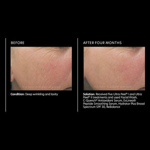 PCA Skin C-Quench® Antioxidant Serum 1.0 oz - European Beauty by B