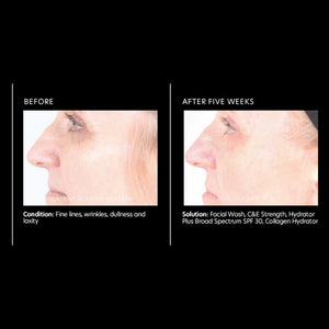 PCA Skin C&E Strength Max 1.0 oz - European Beauty by B