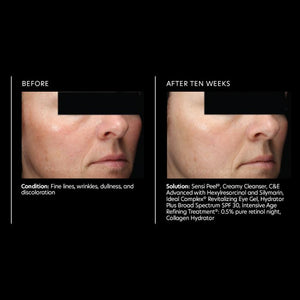 PCA Skin C&E Advanced 1 oz - European Beauty by B