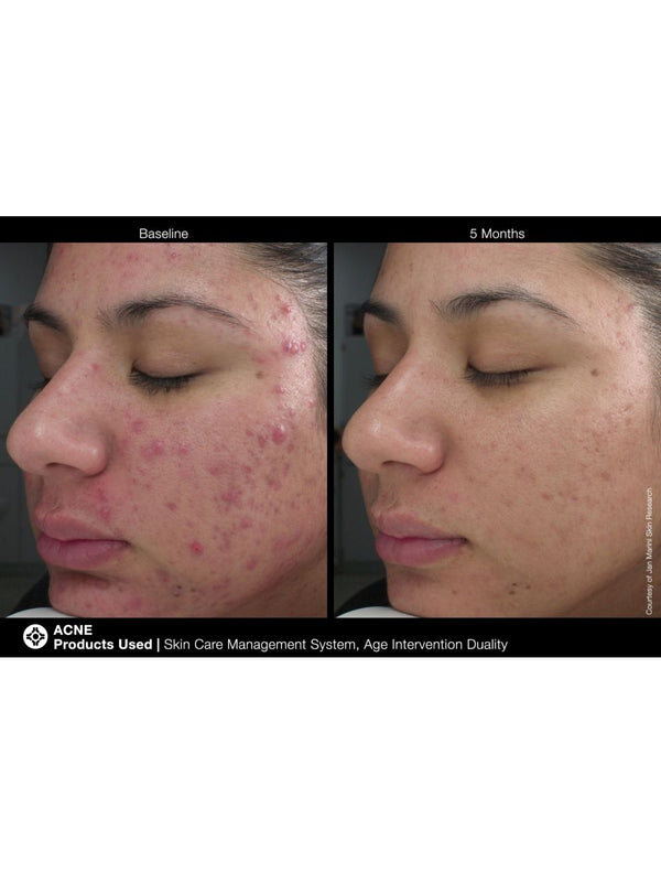 Jan Marini Age Intervention Duality serum for dark spots in a sleek pump bottle with a clean, modern design.