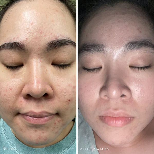 Glowbiotics Probiotic Triple Action Clarifying Pads - product image 6
