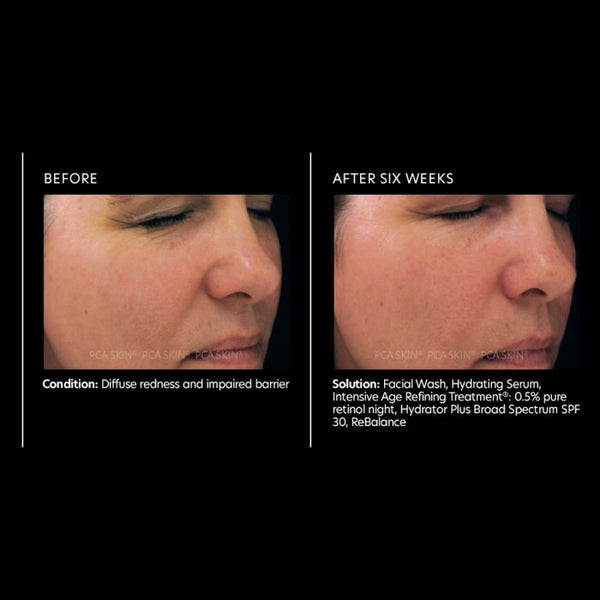 PCA Skin Intensive Age Refining Treatment 0.5% pure retinol 1 oz - European Beauty by B