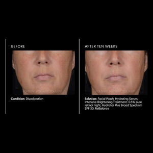 PCA Skin Intensive Brightening Treatment: 0.5% pure retinol 1 oz - European Beauty by B