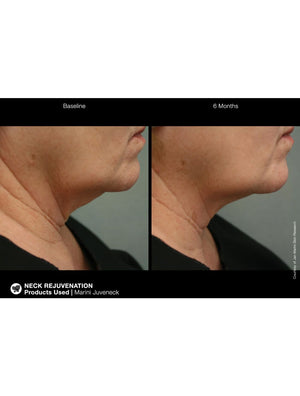 Jan Marini Marini Juveneck - European Beauty by B