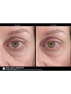 Jan Marini Marini Luminate Eye Gel - European Beauty by B