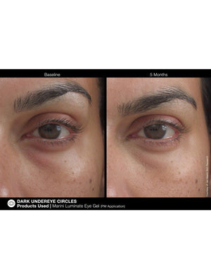 Jan Marini Marini Luminate Eye Gel - European Beauty by B