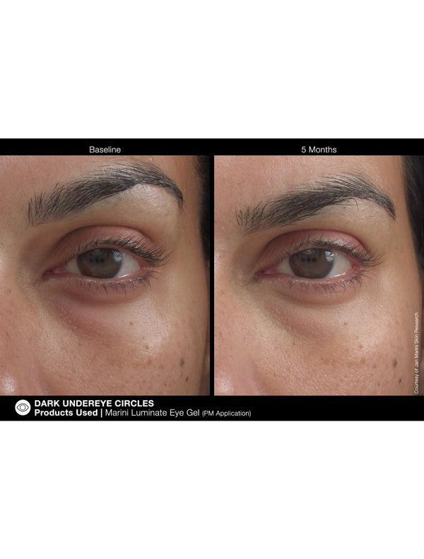 Jan Marini Marini Luminate Eye Gel - European Beauty by B