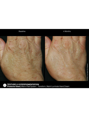Jan Marini Marini ReNu Corrective Hand Complex - European Beauty by B