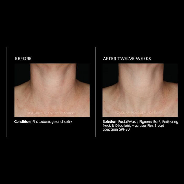 PCA Skin Perfecting Neck and Décolleté 3.0 oz - European Beauty by B