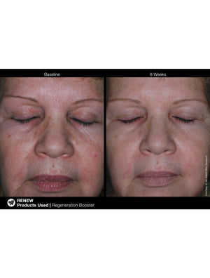 Jan Marini Regeneration Booster face cream in a 1 oz bottle with a sleek design and clear label.